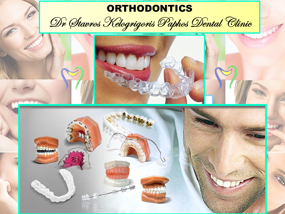 Dr Stavros kelogrigoris Paphos Dental Clinic